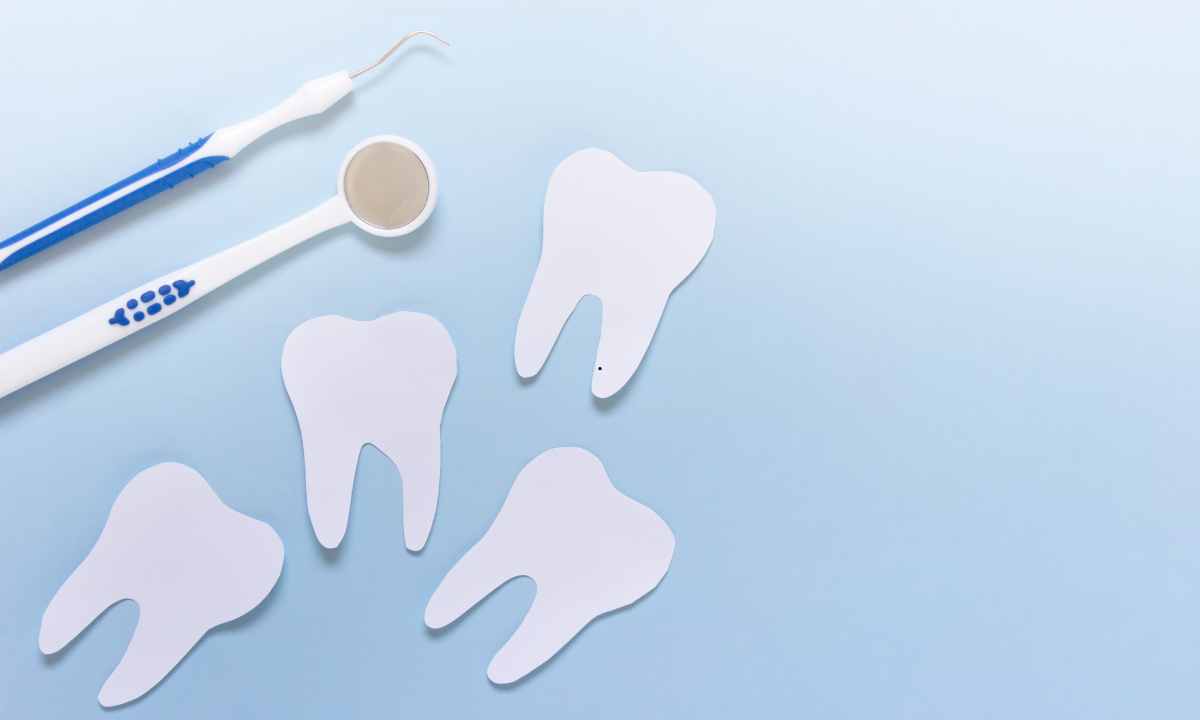 How to Prepare for Your Dental Implant Procedure